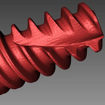 Abutment Dentale